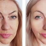 Is cosmetic laser surgery right for you