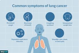 Symptoms of Lung Cancer