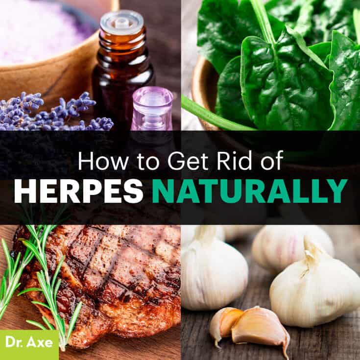 Treat Herpes At Home Natural Remedies