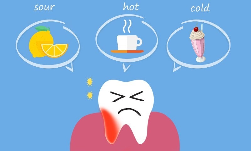 Tooth sensitivity