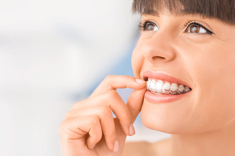 Invisalign: Your Best Choice For Getting A Perfectly Aligned Teeth.