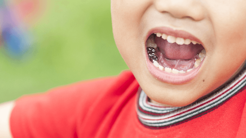 stainless steel crowns in pediatric dentistry