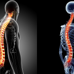 Keeping Your Spinal Cord in Good Shape