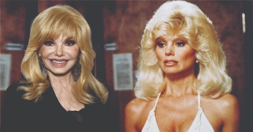 Who is Loni Anderson