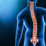 Scoliosis Diagnosis