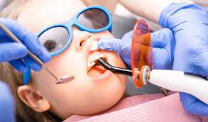 Pediatric Dentistry: Understanding Dental Fillings For Kids